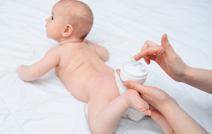 How to Prevent Diaper Rash: Essential Tips for Happy Baby Skin