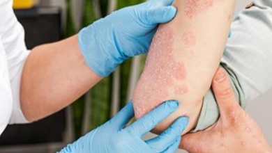 Understanding The Warning Signs Of Serious Skin Conditions