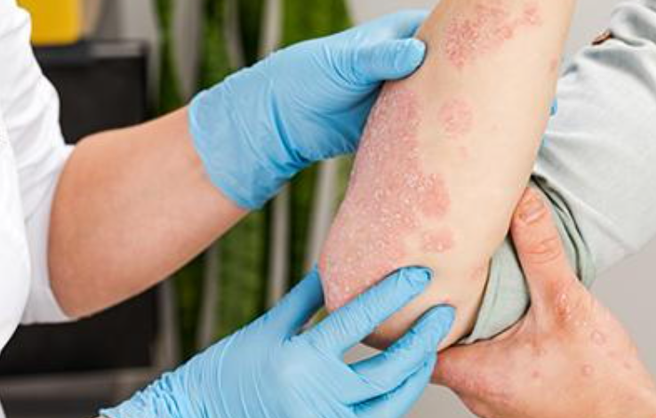 Understanding The Warning Signs Of Serious Skin Conditions